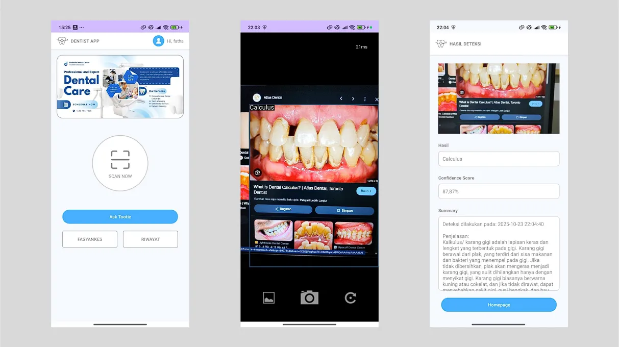 Dentist App – Dental Condition Detection